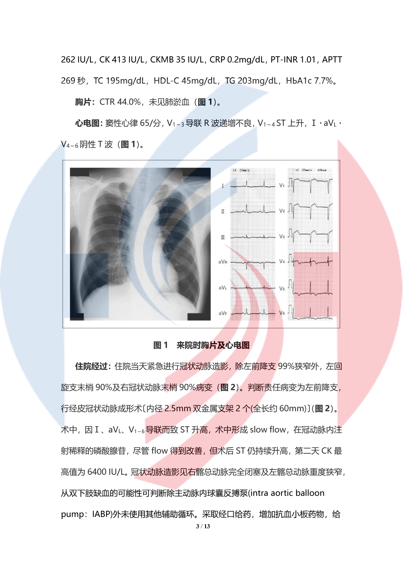 【中譯水印】體外超濾治療急性前壁間壁心肌梗塞后嚴重心力衰竭合并長期存活中的室間隔穿孔1例_頁面_03.png